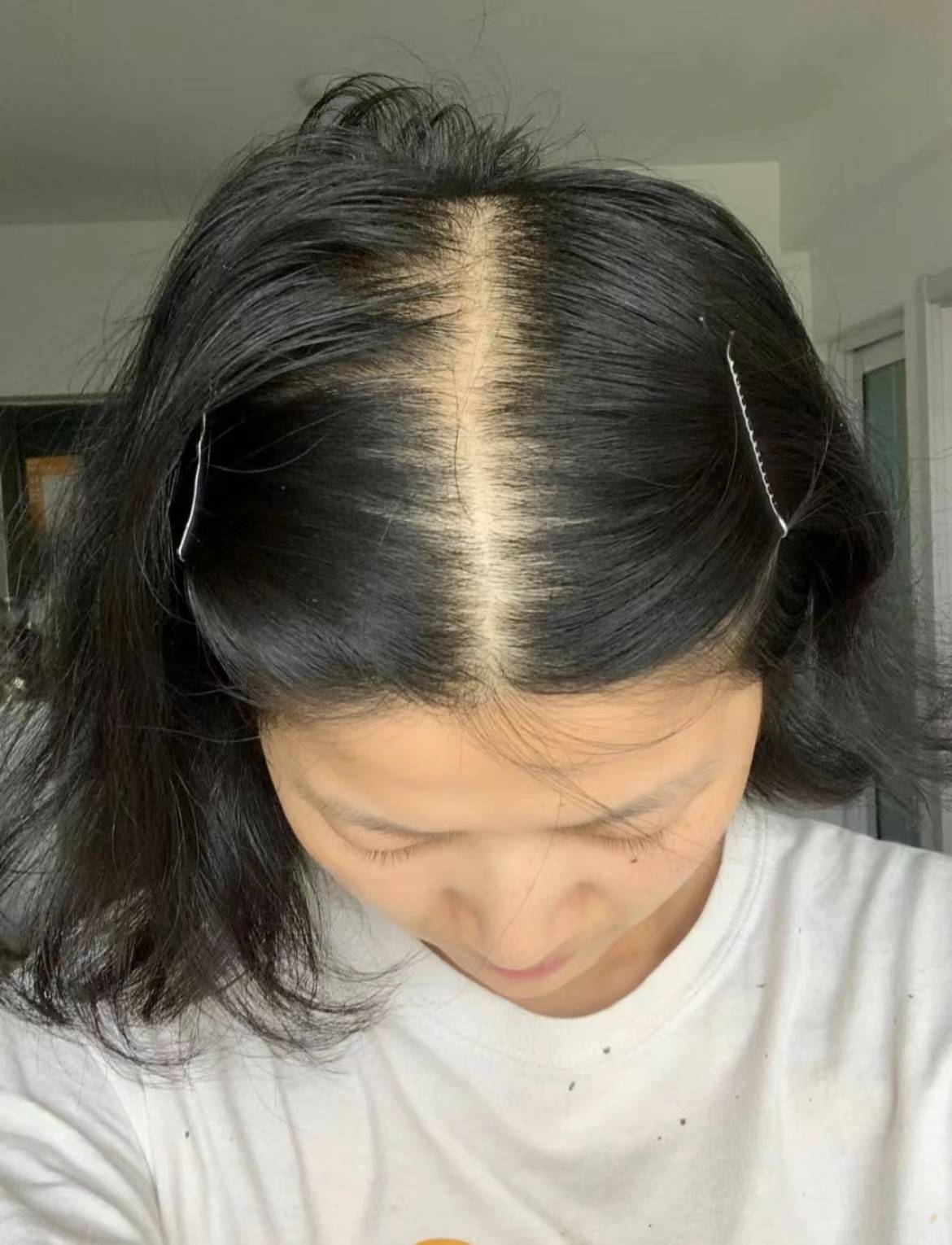 下面我会把自己的经验分享出来需要生发的宝宝可以看看我是怎么做的