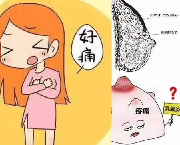 乳腺照片卡通图片