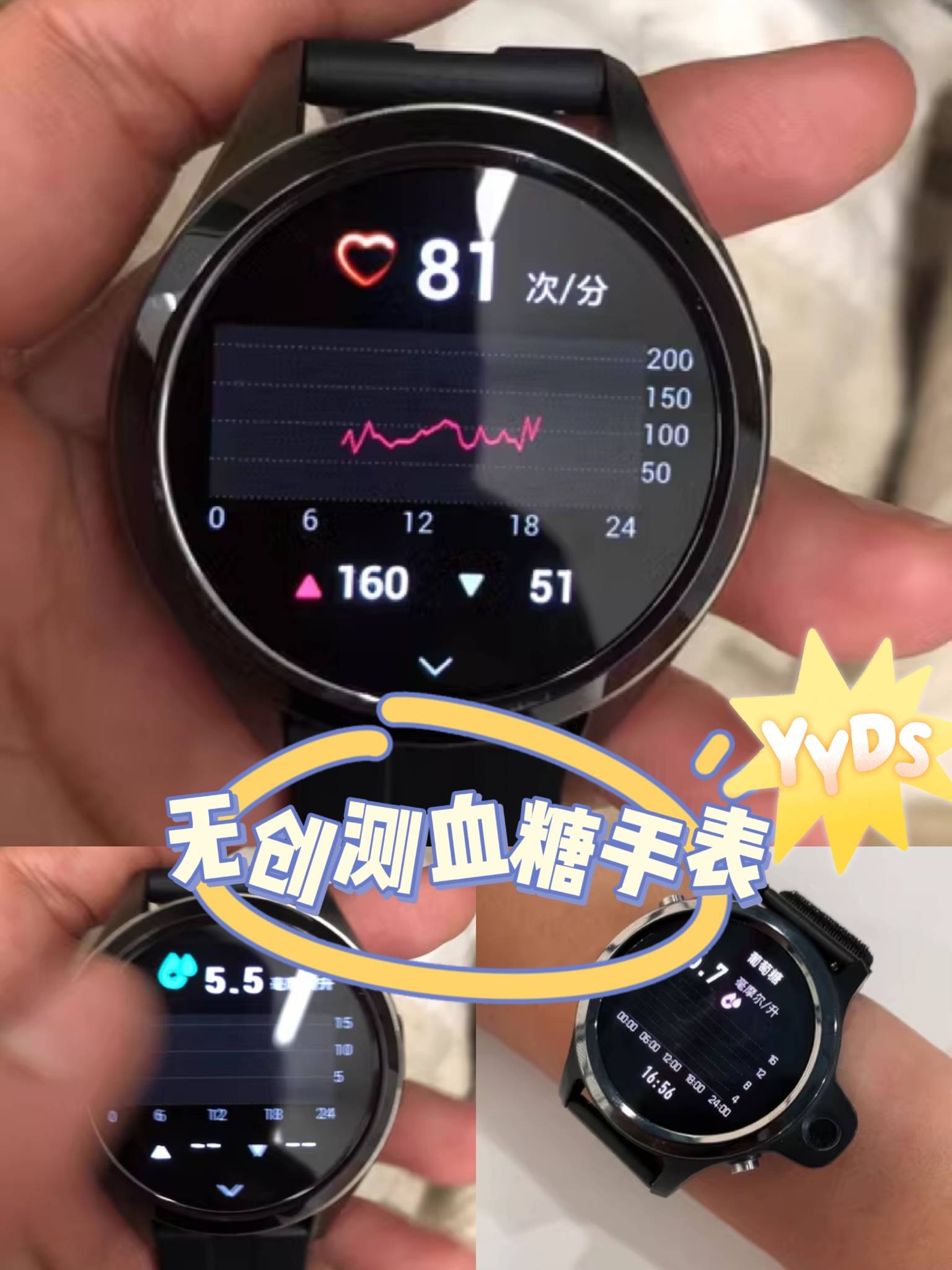 特别是家里的老人更是排斥,所以无创测血糖手表真的是"糖人"们的福音