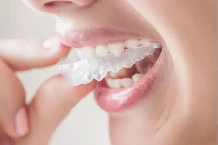 邢台成年人矫正牙齿需要注意什么?