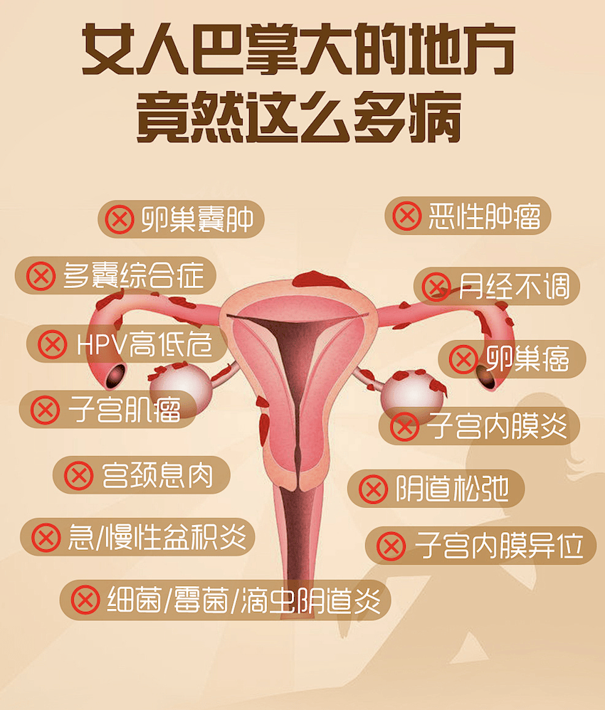 妇科病图片真人图片