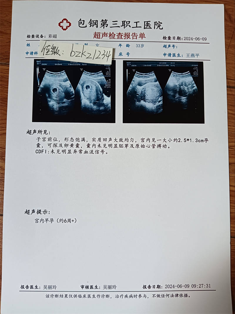 一键生成假怀孕b超单