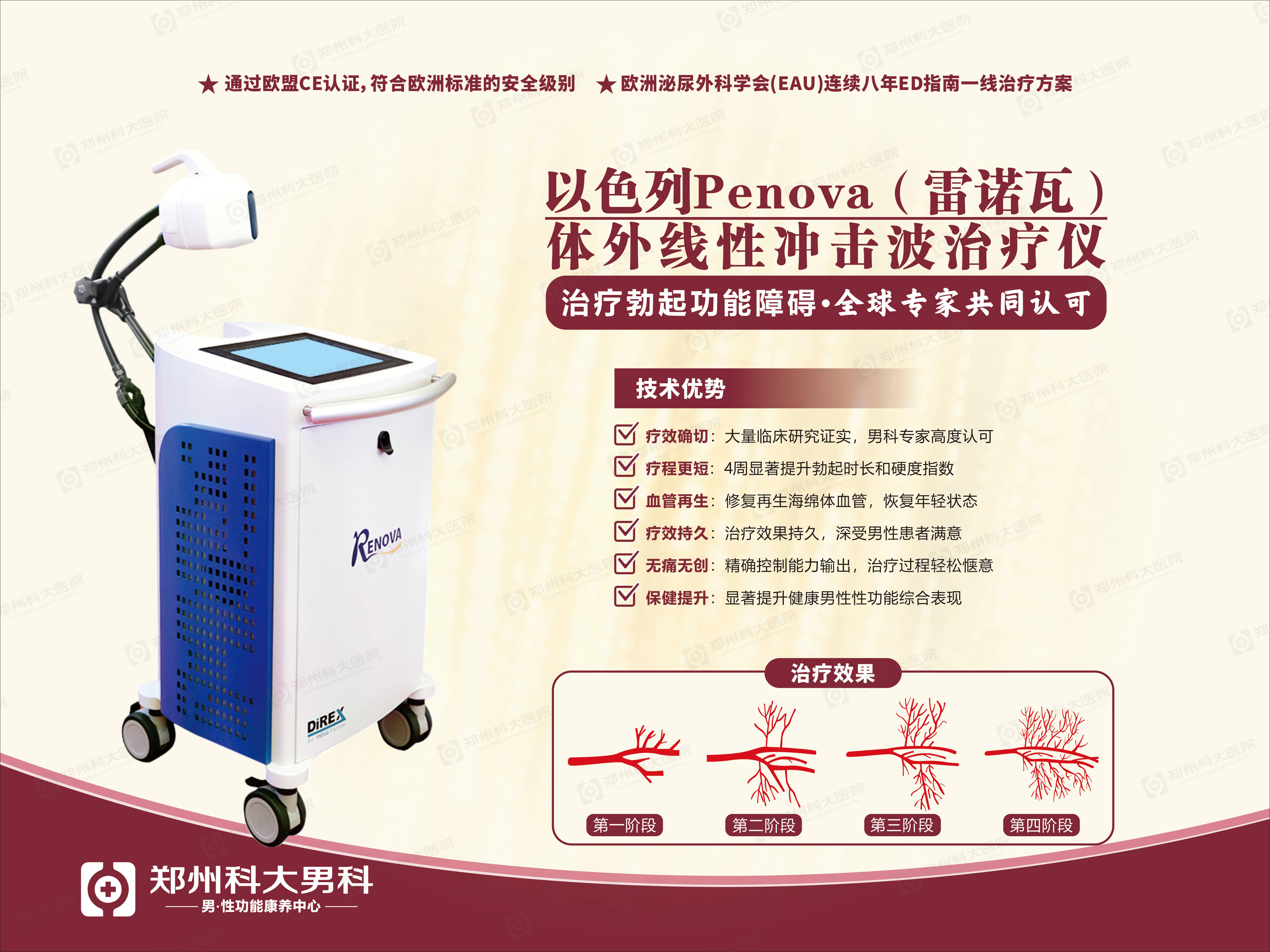 在省内率先引进以色列renova(雷诺瓦)体外线性冲击波ed(男性性功能