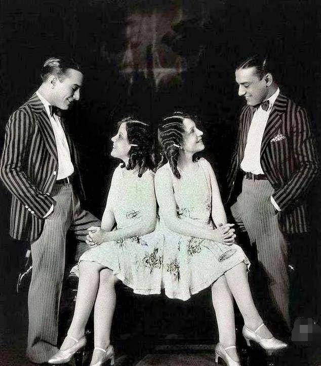 英国连体姐妹:被人当成赚钱工具,姐姐死后,妹妹与遗体共存2天