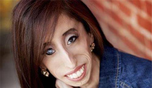 她出生时被人当作怪物,体重只有25公斤,追她的帅哥却排成长龙