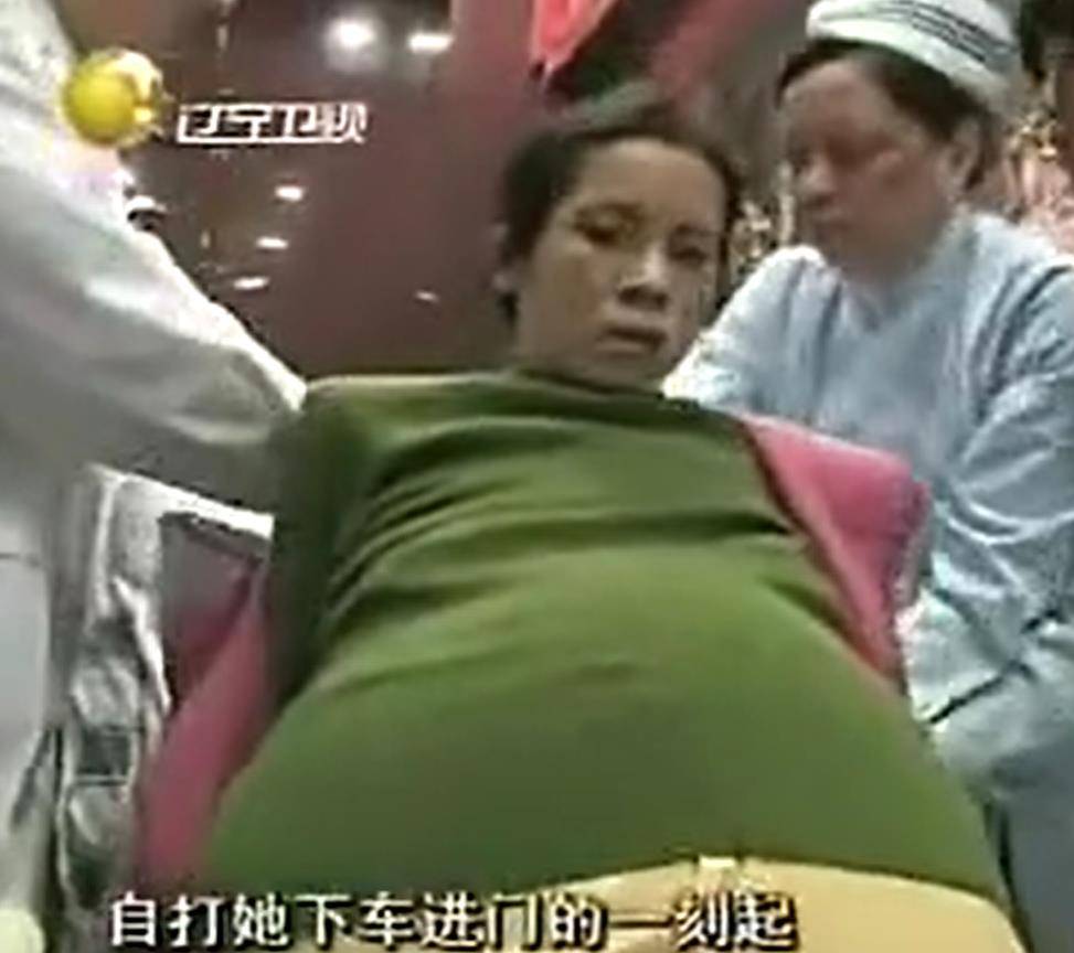 09年广东女子挺55公斤巨肚,怀孕11月未生,医生检查却看不见孩子