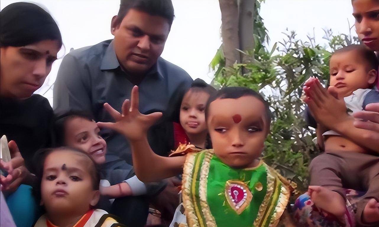 原创印度8岁男孩脑袋形似漏斗,被人奉为象头神,医生:恒河水造成的