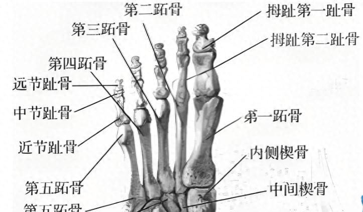 第一跖骨短缩的定义与成因第一跖骨短缩是指在拇外翻手术中,由于截骨