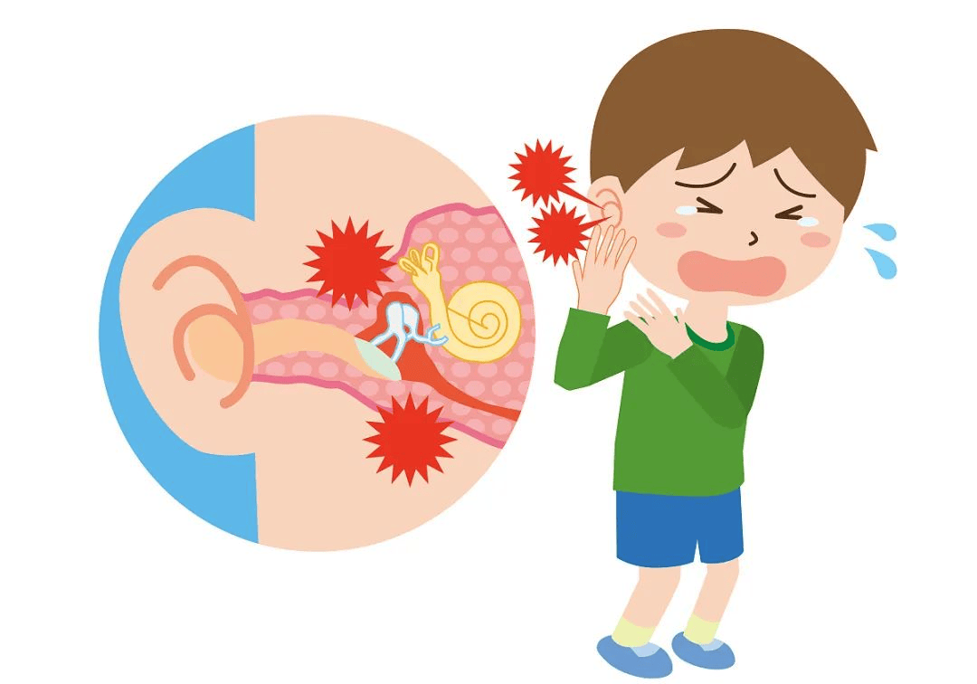 万聪无为助听器急性中耳炎为什么多发于儿童孩子耳朵痛怎么回事