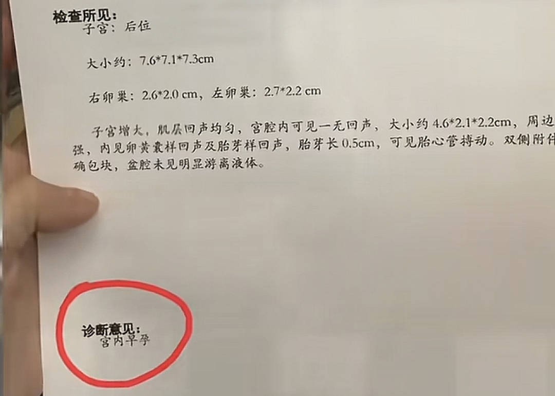 "涉事医院出具的b超检查结果第一次检查:医生直接"判死刑"7月14日,该