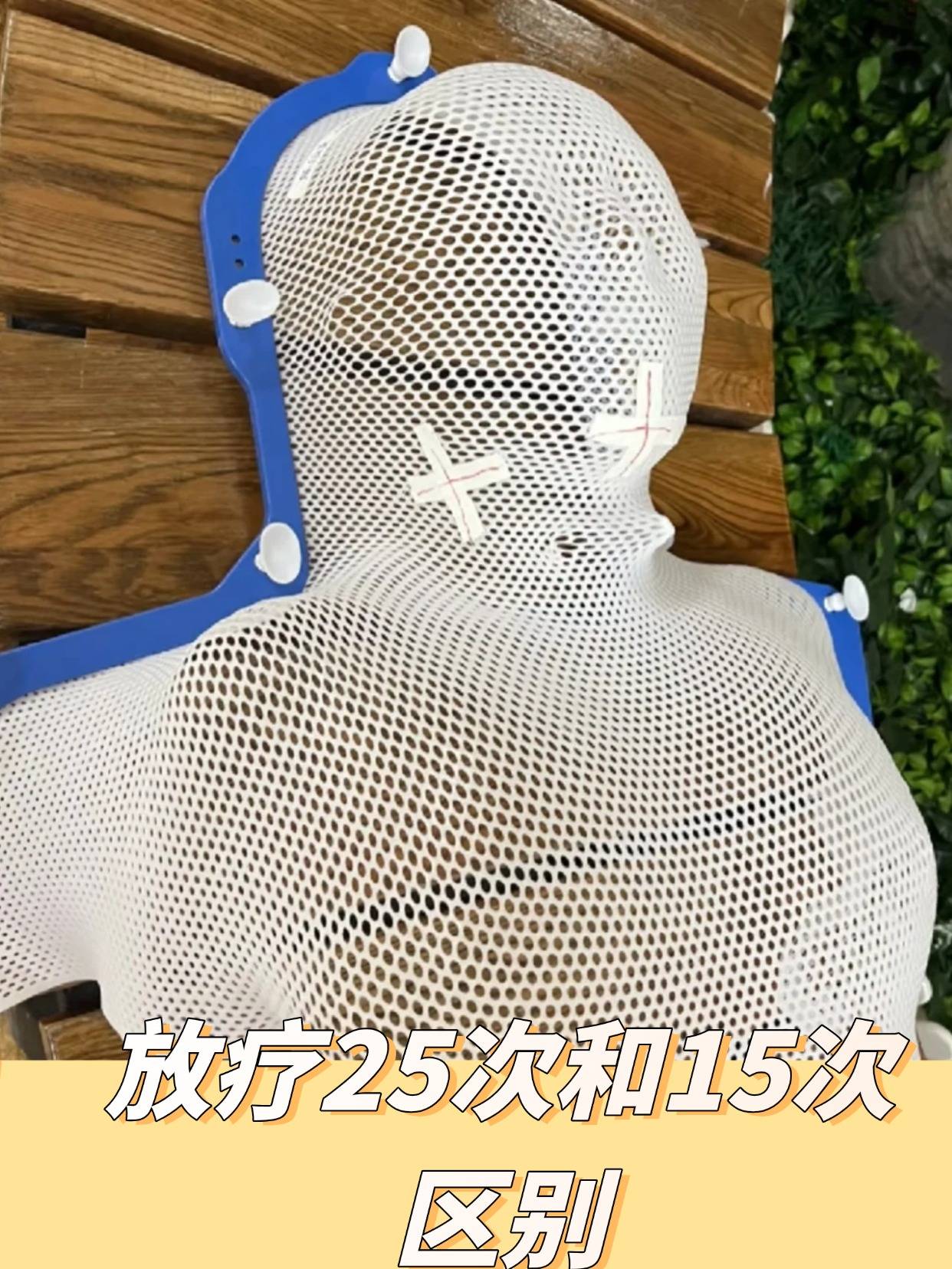 放疗25次和15次区别放疗全攻略
