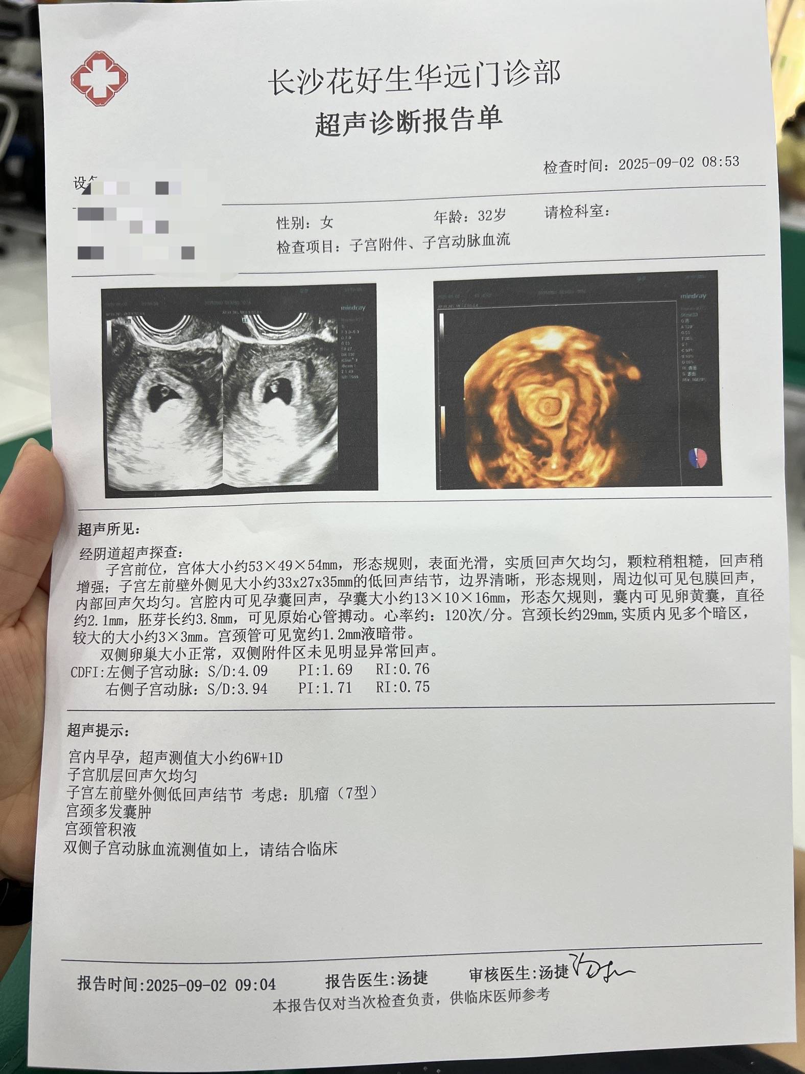 欣易康达分享:激动的要哭了,精子碎片高64,一次成功刚有了胎心胎芽!