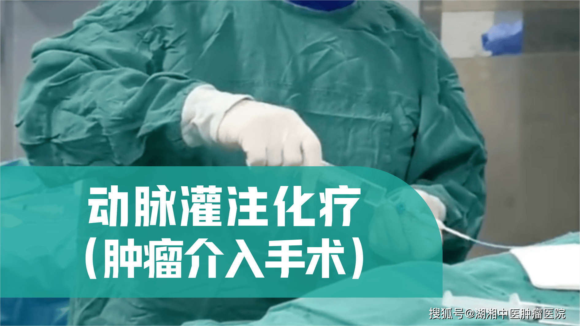 动脉灌注化疗.png