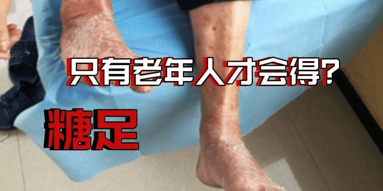 糖足只有老年人才会得？这类中青年人群同样高危