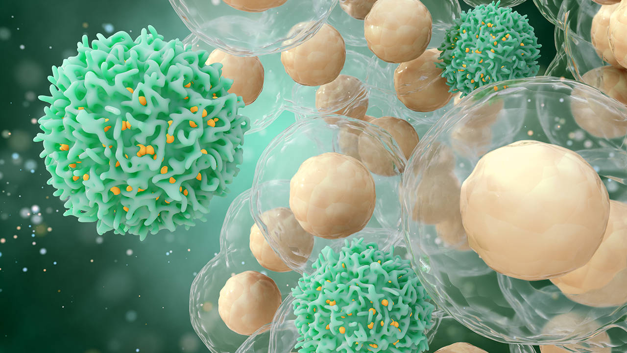 肺癌转移要不要放疗转移怎么治能好