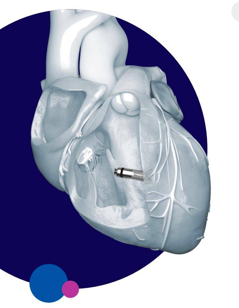 美敦力新一代微型无导线心脏起搏器,获ce认证!