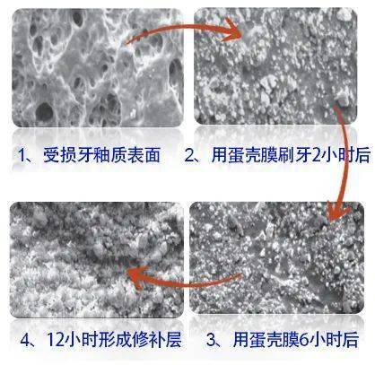 家家都有這材料_蛋殼_amave_牙釉質