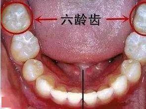 寶寶牙不好怎麼辦?_兒童_口腔_治療