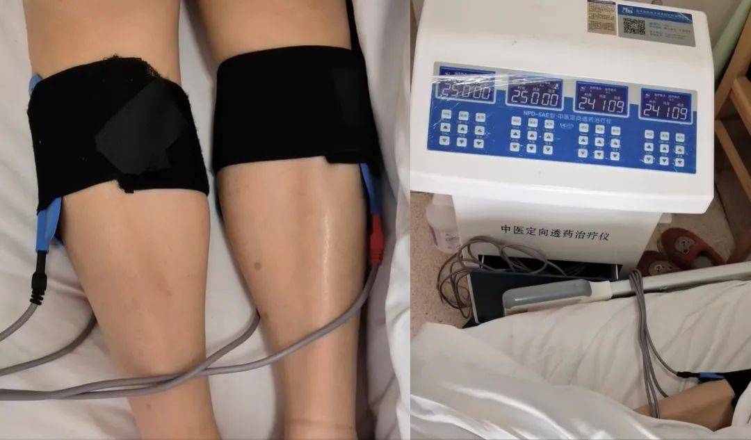 普陀这个工匠创新工作室让糖尿病"无处遁形"_雷涛_并发症_病变