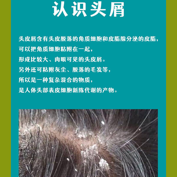 头皮屑毛囊炎等头皮问题产生的原因:头皮屑和头皮红疹产生的原因多种