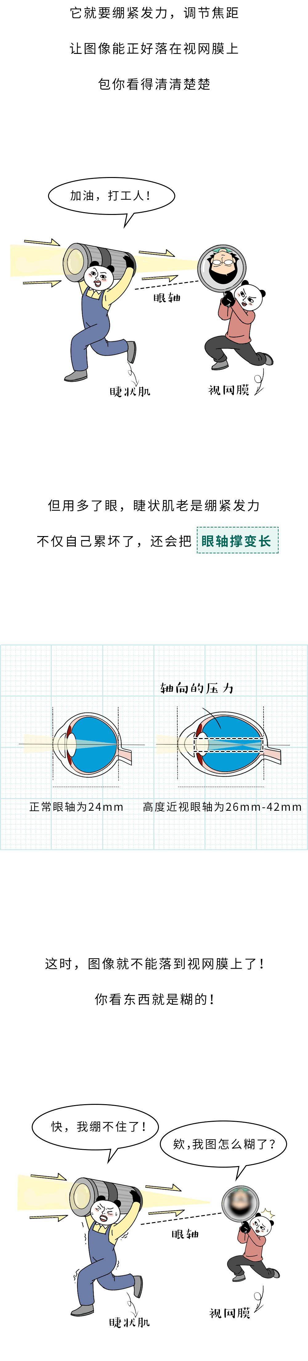 近視的人不戴眼鏡,時間久了會怎麼樣?_雜誌_屈光_公眾