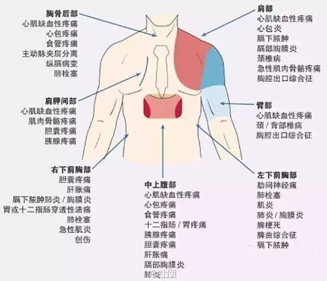 19.一張圖記住不穩定心絞痛和心肌梗死的發病機理與鑑別20.心臟聽診