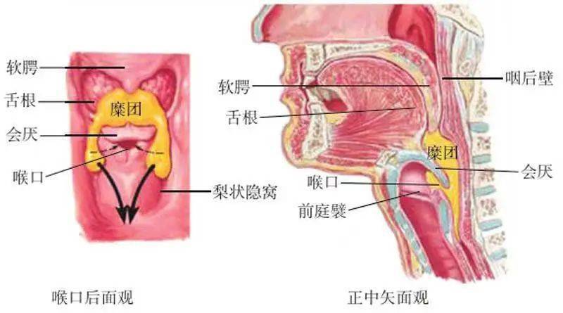 咽部后壁示意图图片