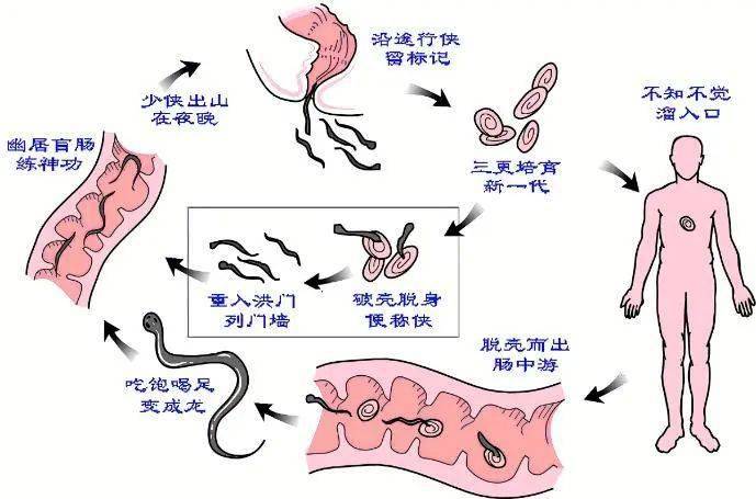 蛲虫图片病人图片