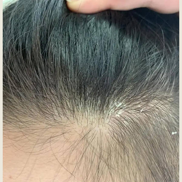 洗发水排行榜前十名去屑控油_头皮_问题_建议