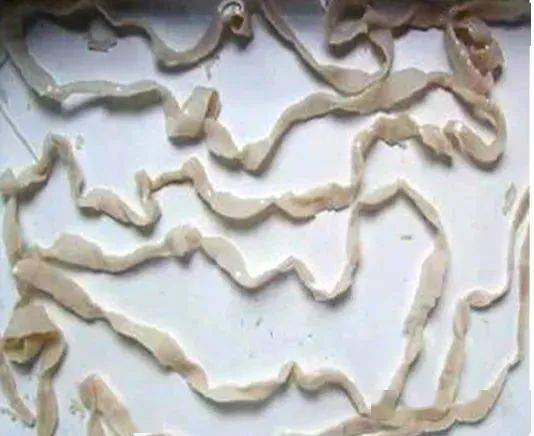 医生:这种"饮食流行"别跟风_绦虫_赵女士_寄生虫