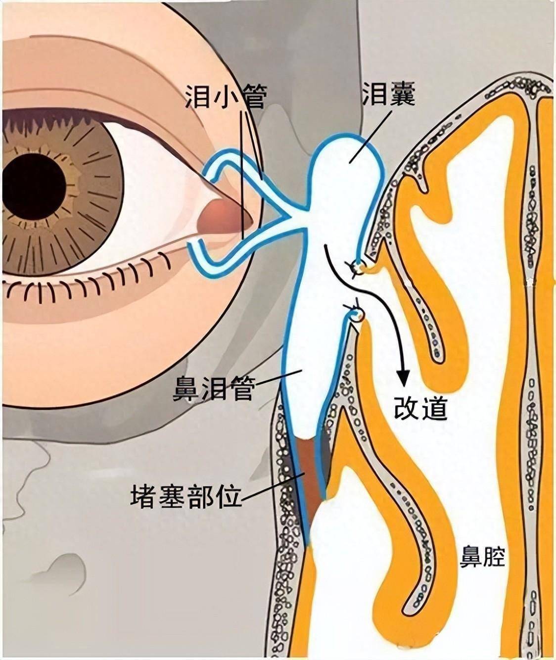 長沙市愛爾眼科成功實施鼻內鏡手術 醫院眼眶病診治邁