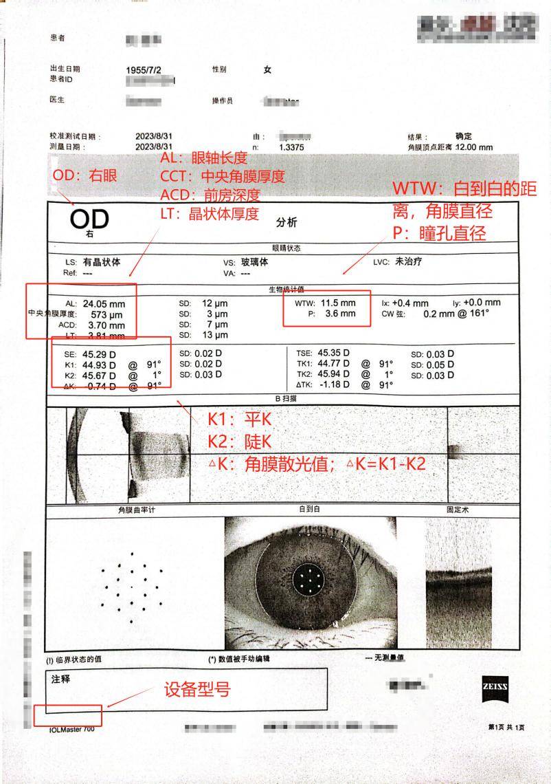 眼科临床试验检查报告的质量风险点及案例分享