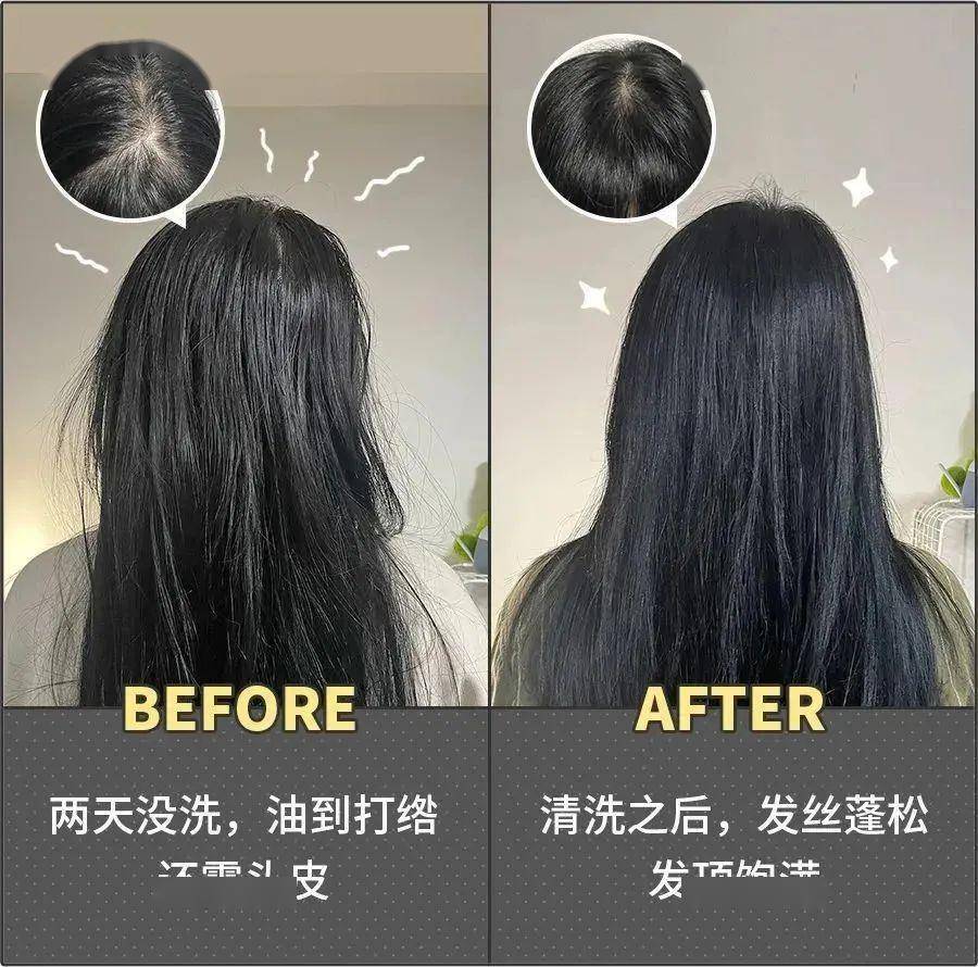 一个新玩意儿,还真能挽回头发_效果_产品_来源