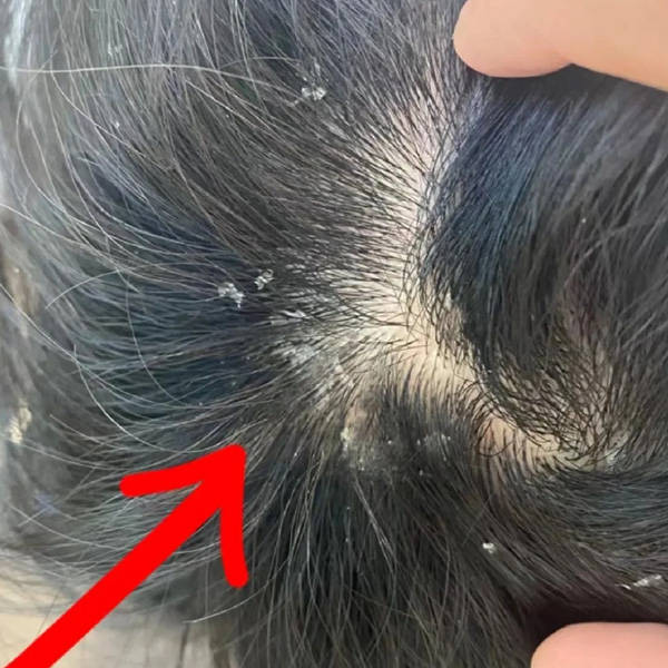 洗发膏去屑止痒去油推荐