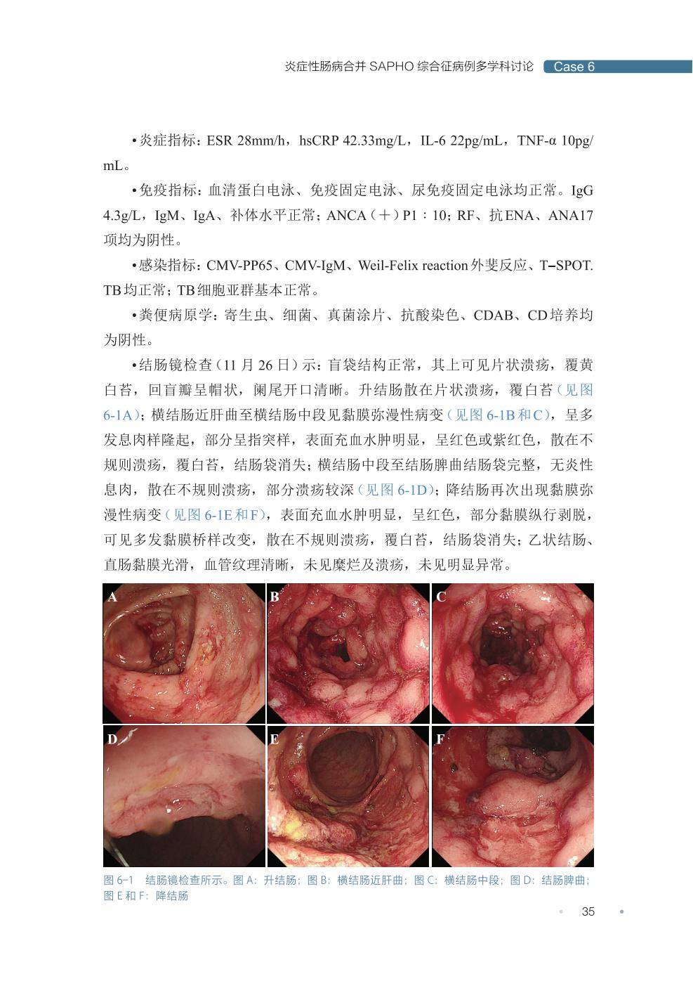 薦書| 臟腑疑雲多魅影有待龍行龘龘,疑難腸病點迷津更