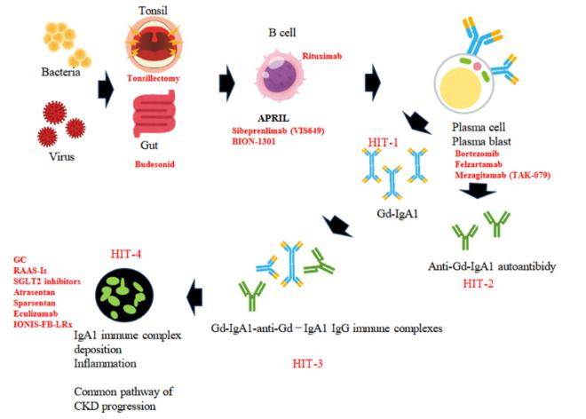 该综述以图文形式生动讨论了gd-iga1和"四重打击"学说(图1).