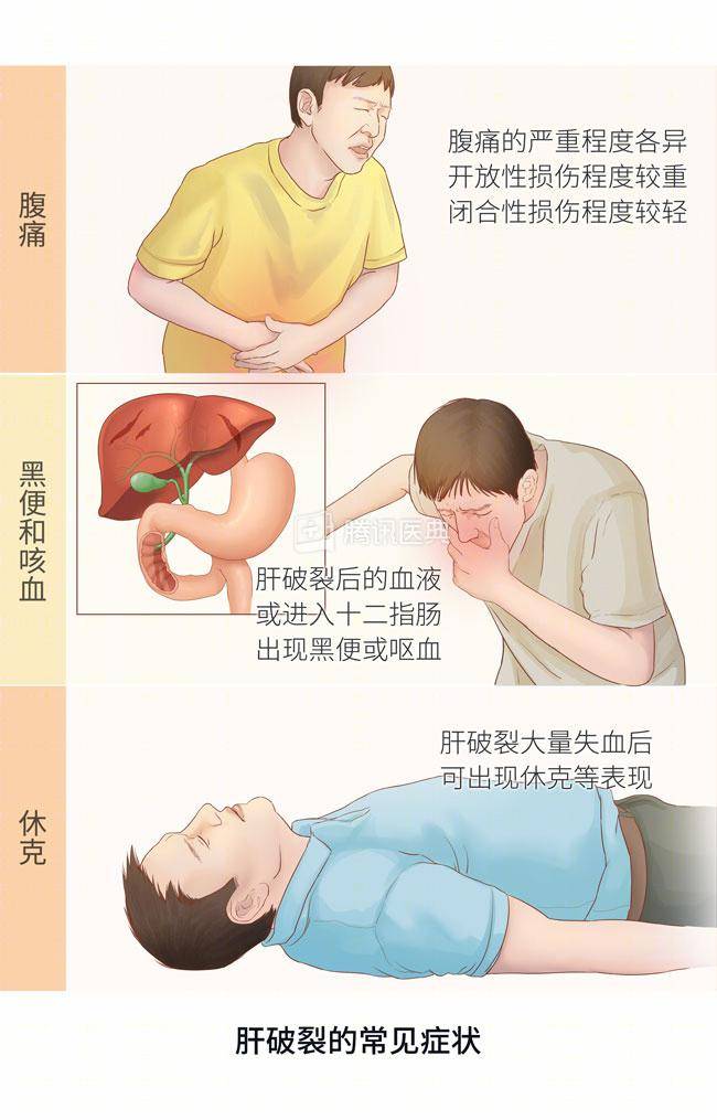 男子外伤致肝破裂!微创手术抢救化险为夷_吴先生_家属_治疗