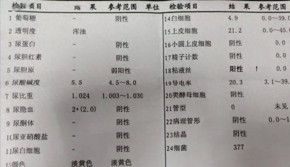 反复血尿查了一圈,没有发现病因,找我开单我发现了病因