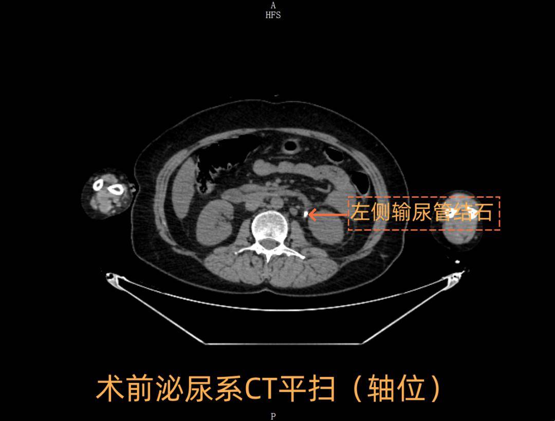 中西医协同攻克重症91 | 与"死神"赛跑!