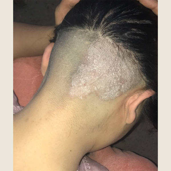 二硫化硒洗发水可以每天用吗?去屑控油洗发水推荐_头皮_头发_成分