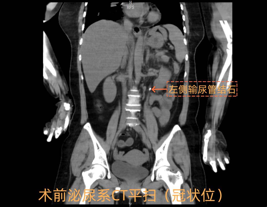 中西医协同攻克重症91 | 与"死神"赛跑!