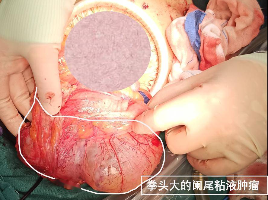 治疗_温州市_手术