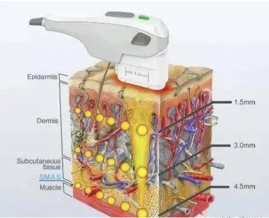 她要和ai结婚了!_治疗_技术_仪器