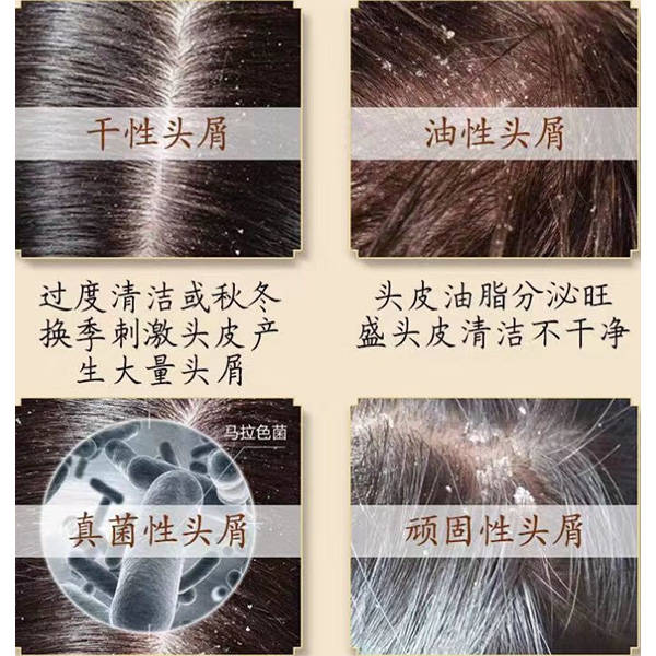 头皮_头发_产品
