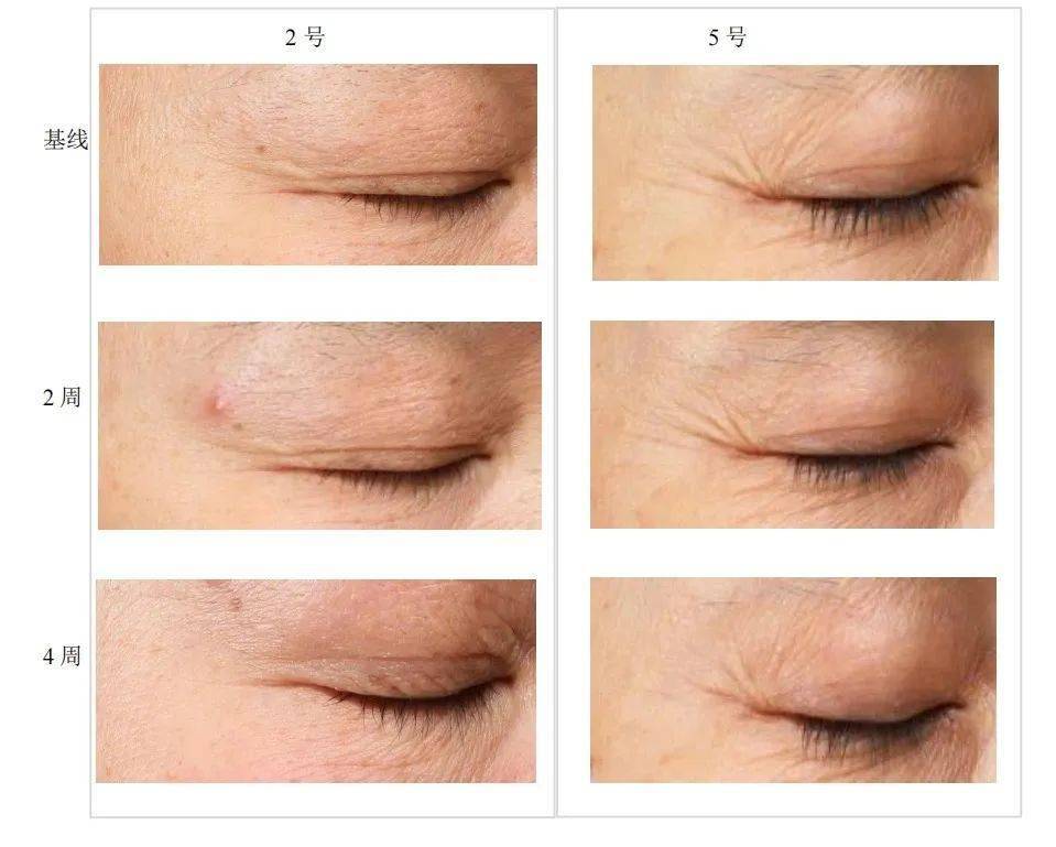 36岁素颜的赵丽颖,打了半个内娱明星的脸._专场_成分_直播