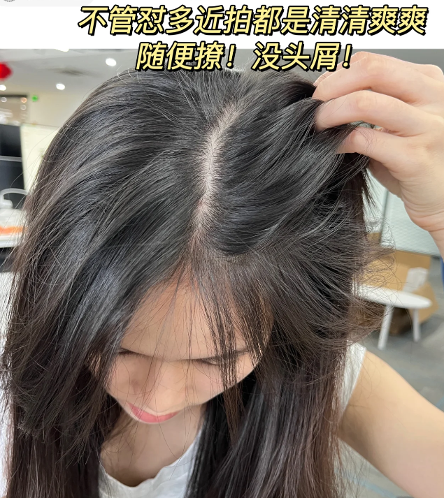 有效止痒的洗发水推荐_头皮_去屑_问题