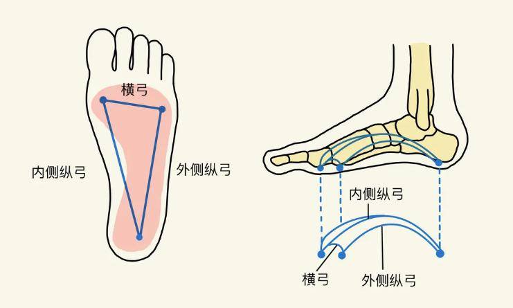 扁平足的矫正方法图解图片