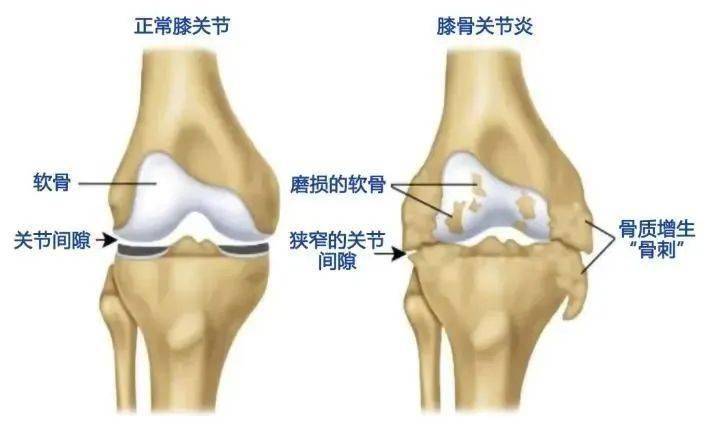 一组x光照片改变了李大妈的生活