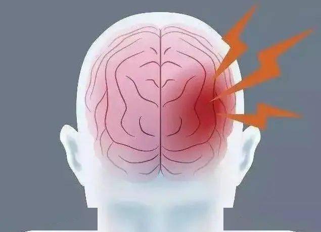 脑梗是"拖"出来的?睡觉时若有这3个现象,尽量引起重视!_阿姨_时候_因