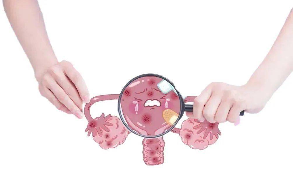 子宫内膜过薄卵巢是否出现了多囊卵巢综合征等相关情况导致的血性白带
